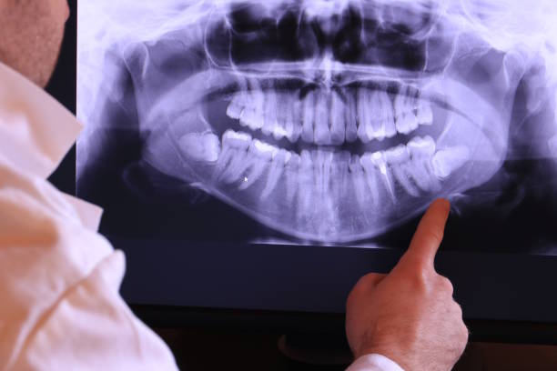 Best Urgent Dental Care for Toothache in Chester, VA