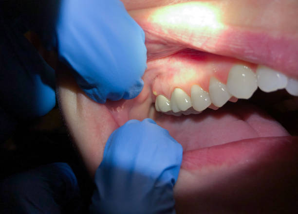 Best Orthodontic Emergency Dentist in Chester, VA